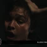 bleeding